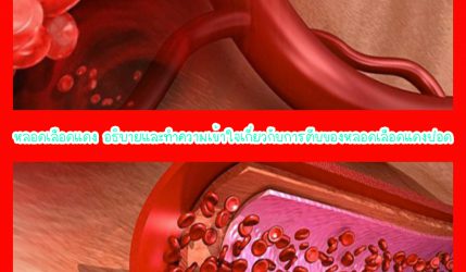 หลอดเลือดแดง อธิบายและทำความเข้าใจเกี่ยวกับการตีบของหลอดเลือดแดงปอด